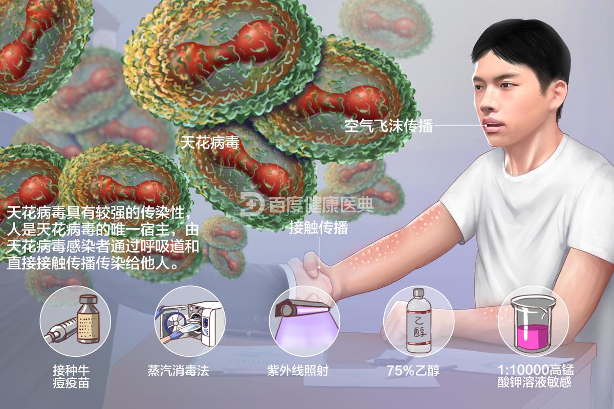 为什么天花是唯一被消灭的，天花为什么灭绝了？-第5张图片-屿企百科网