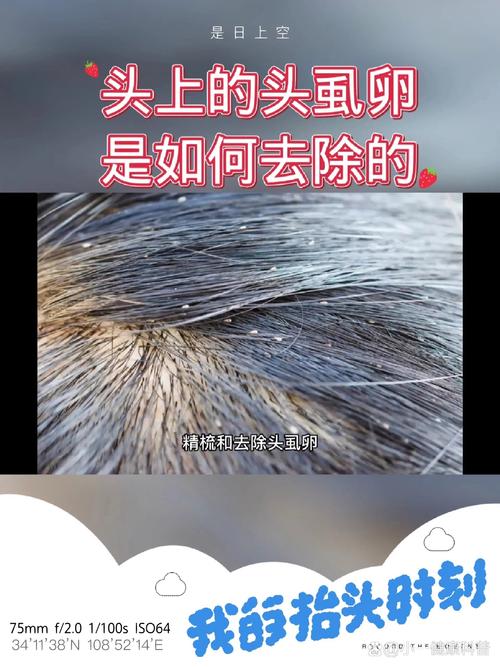 除床虱最简单的方法，怎样除掉床虱-第3张图片-屿企百科网