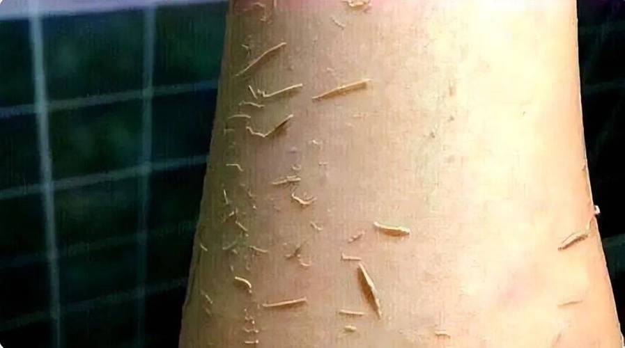 搓澡搓下来的泥是什么东西，搓澡搓出的泥到底是什么？-第1张图片-屿企百科网