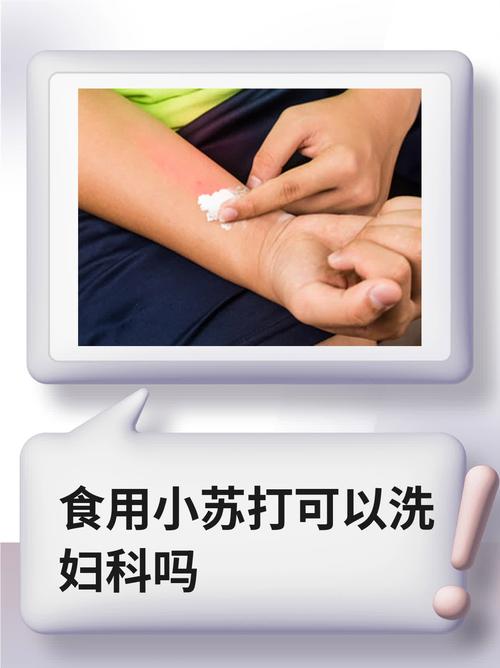 小苏打洗内裤有抑菌作用吗,用小苏打洗内裤能杀霉菌吗?-第4张图片-屿企百科网 小苏打洗内裤有抑菌作用吗,用小苏打洗内裤能杀霉菌吗?-第4张图片-屿企百科网