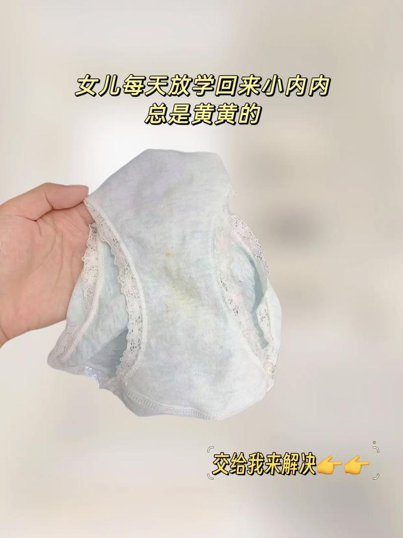 小苏打洗内裤有抑菌作用吗,用小苏打洗内裤能杀霉菌吗?-第7张图片-屿企百科网 小苏打洗内裤有抑菌作用吗,用小苏打洗内裤能杀霉菌吗?-第7张图片-屿企百科网