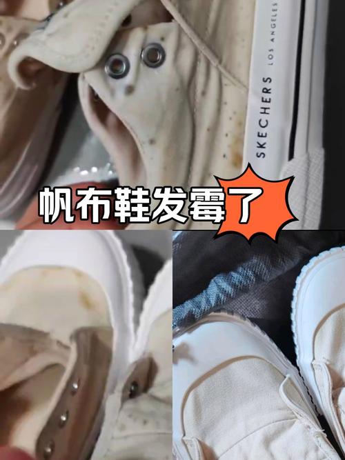 布鞋霉斑怎么去除小窍门，布鞋霉了怎么办-第4张图片-屿企百科网