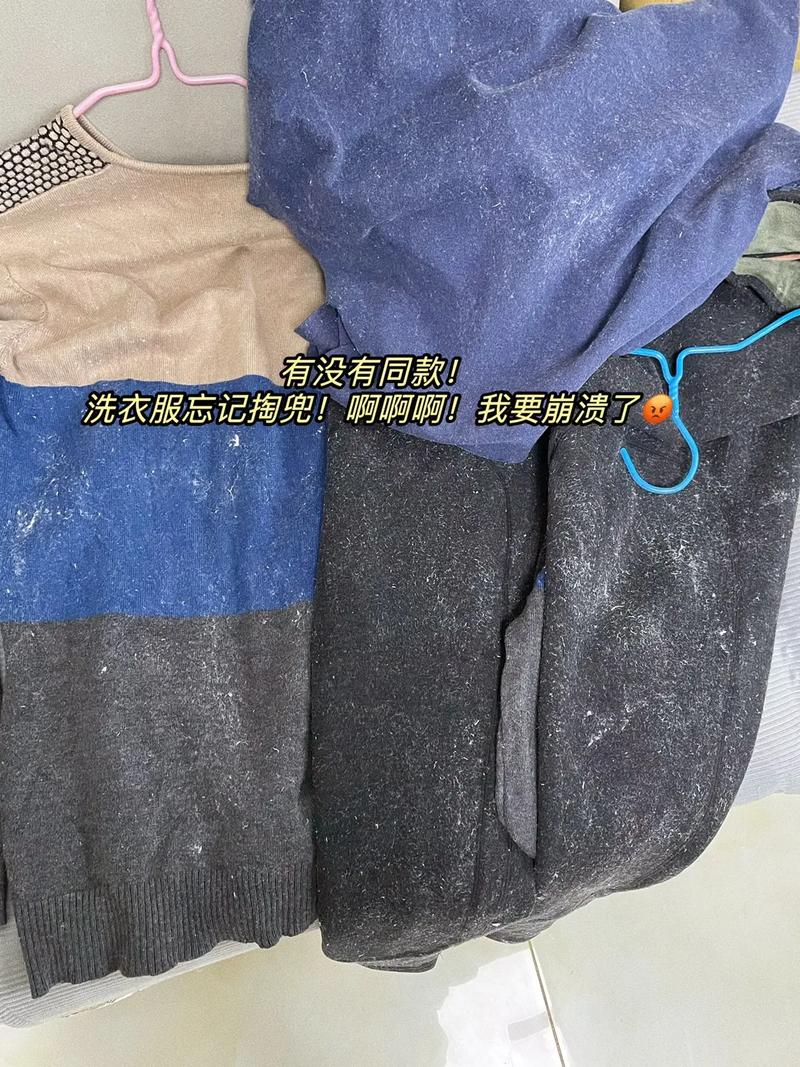 白衣服粘毛是质量不行吗,白色衣服黏毛怎么去掉?-第3张图片-屿企百科网 白衣服粘毛是质量不行吗,白色衣服黏毛怎么去掉?-第3张图片-屿企百科网