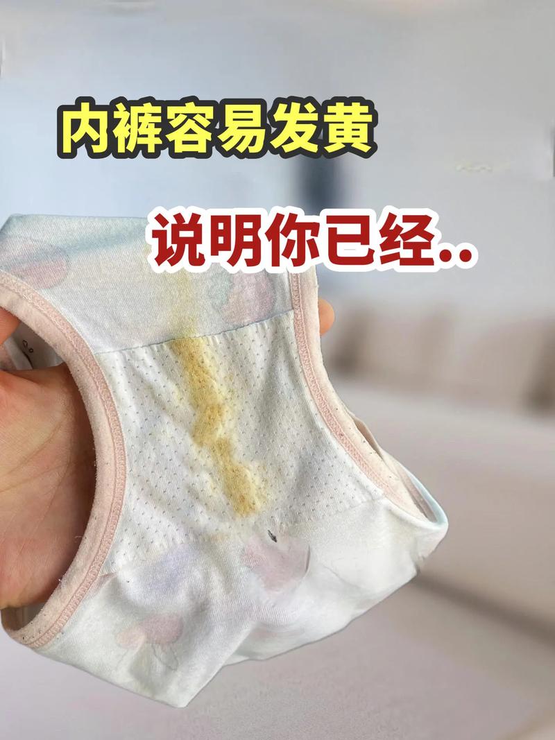 不小心烧了自己的内裤有事吗？烧掉自己内裤有什么忌讳？-第2张图片-屿企百科网