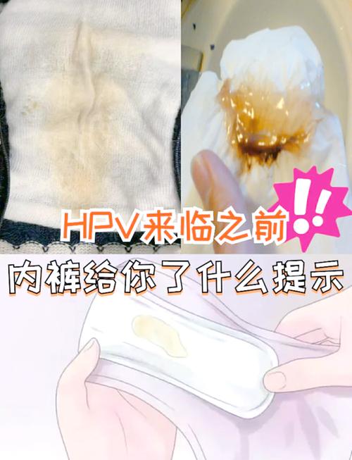 内裤隔夜洗会得妇科病吗，内裤经常隔夜洗-第4张图片-屿企百科网