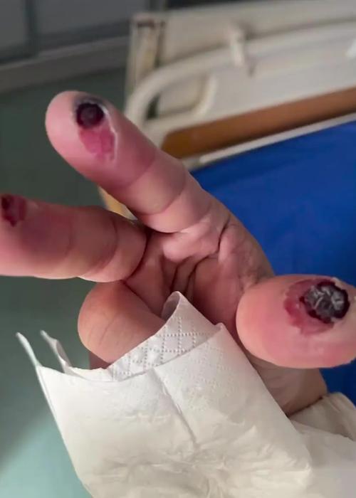 床上小黑虫是什么虫子，床上小黑虫是什么虫子叮咬后中成药？-第6张图片-屿企百科网