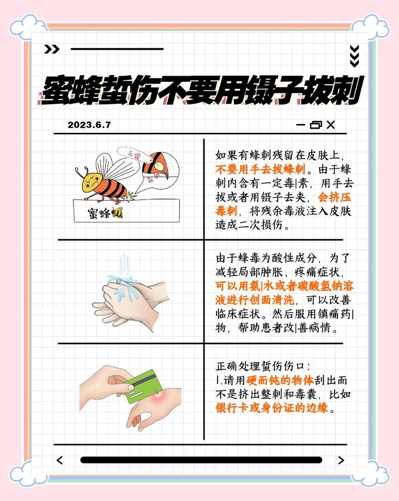 蜜蜂为什么会蜇人，不小心被蜜蜂蜇伤怎么处理最有效？蜜蜂为啥蜇人？-第4张图片-屿企百科网