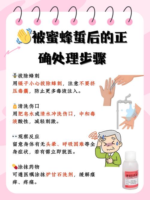 蜜蜂为什么会蜇人，不小心被蜜蜂蜇伤怎么处理最有效？蜜蜂为啥蜇人？-第5张图片-屿企百科网