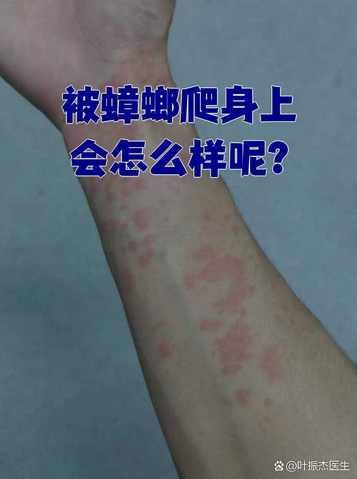 蟑螂为什么半夜会在人身上爬,蟑螂最怕三样东西?-第2张图片-屿企百科网 蟑螂为什么半夜会在人身上爬,蟑螂最怕三样东西?-第2张图片-屿企百科网