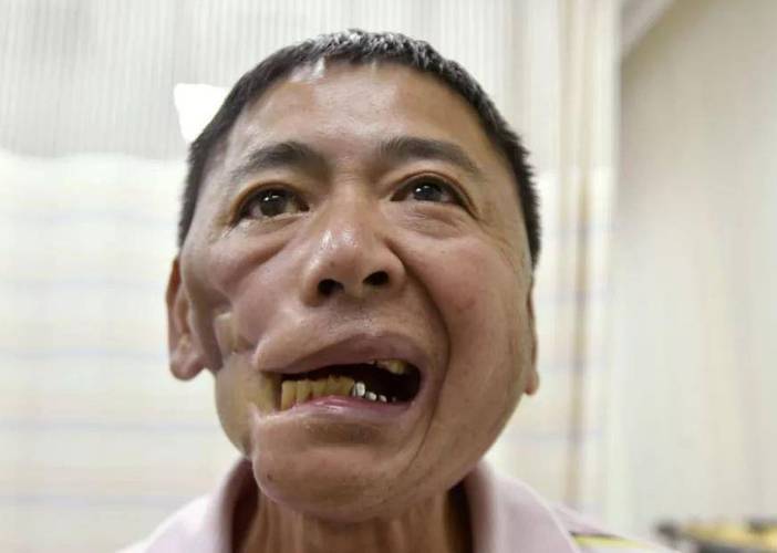 吃槟榔为什么会上瘾,吃槟榔的危害有哪些,吃槟榔为什么会上瘾,吃槟榔的危害有哪些呢?-第3张图片-屿企百科网 吃槟榔为什么会上瘾,吃槟榔的危害有哪些,吃槟榔为什么会上瘾,吃槟榔的危害有哪些呢?-第3张图片-屿企百科网