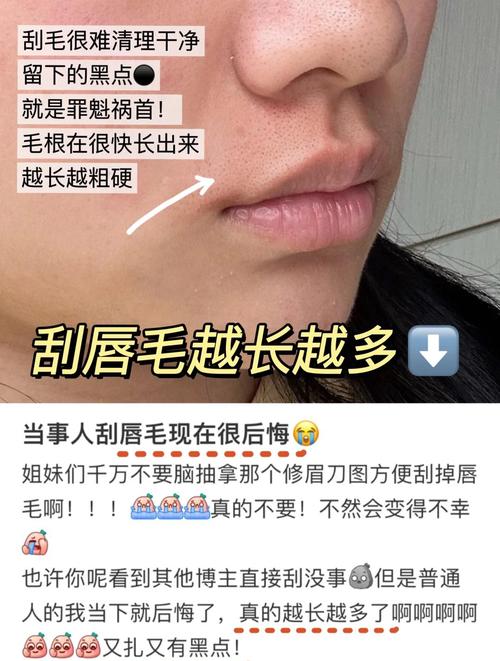 永久脱胡子什么方法比较好,永久脱胡子是真的吗-第7张图片-屿企百科网 永久脱胡子什么方法比较好,永久脱胡子是真的吗-第7张图片-屿企百科网
