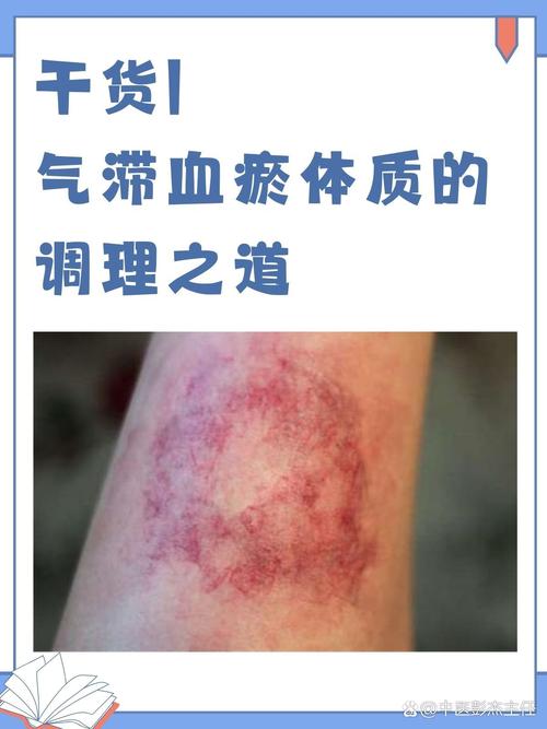这地方成了气候是什么意思，就气候而言,这个城市是生活的理想之地-第4张图片-屿企百科网